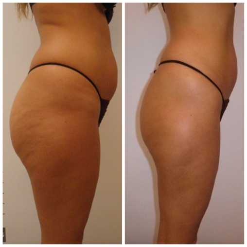 BOX OUT Karinafinalpics